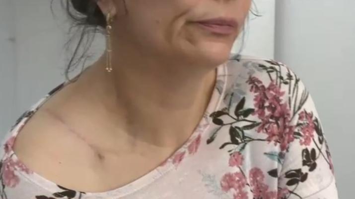  O femeie s-a ales cu o arsură de gradul 3 în timpul RMN-ului, la o clinică privată