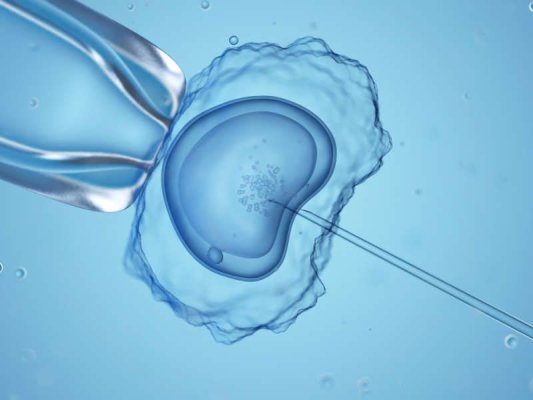 Ce este fertilizarea in vitro și cui îi este recomandată?