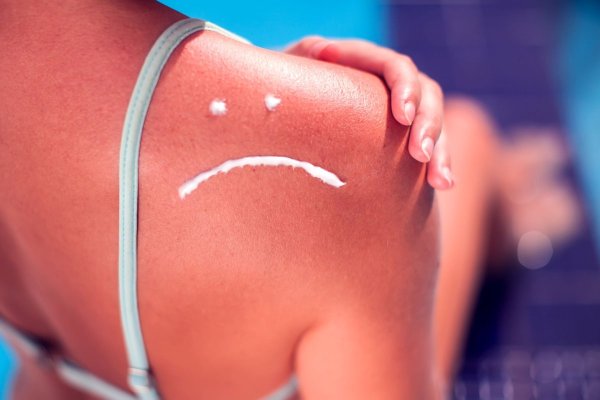 Cum poți preveni efectele negative ale soarelui asupra pielii?