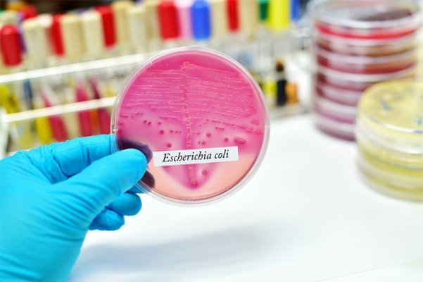 Sanofi şi Janessen vor dezvolta un vaccin împotriva patogenului extraintestinal E.coli