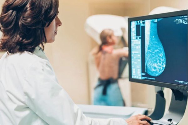 Ce trebuie să știi înainte de o mamografie. Cum să te pregătești cel mai bine