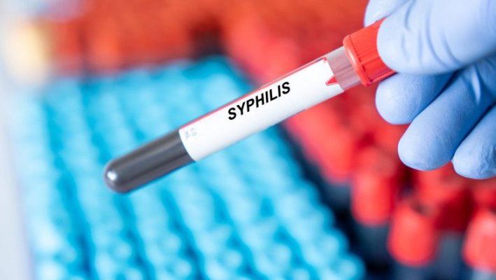 OMS: „Îngrijorări majore“ din cauza celor 8 milioane de cazuri de infectare cu sifilis pe an