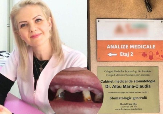 Medicul stomatolog acuzat de o pacientă că i-a pus o proteză dentară... nepotrivită vine cu lămuriri!