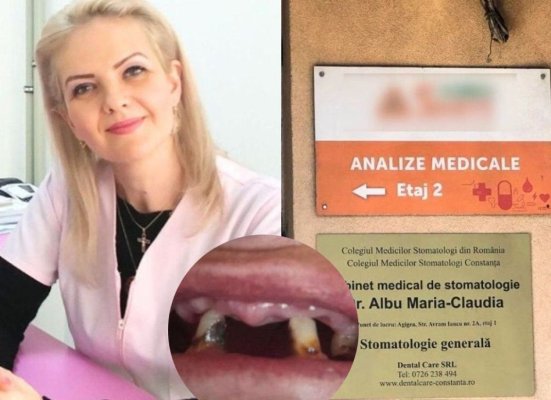 Medicul stomatolog acuzat de o pacientă că i-a pus o proteză dentară... nepotrivită vine cu lămuriri!