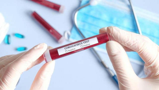 Un nou test de coronavirus dezvoltat de Roche, autorizat de urgenţă în SUA