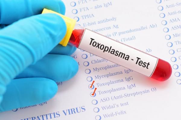 Cum se transmite toxoplasmoza și pentru cine este periculoasă această boală parazitară